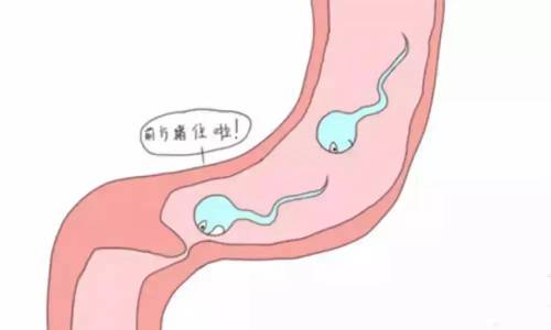 做输卵管宫腹腔镜手术前后有什么要注意的?