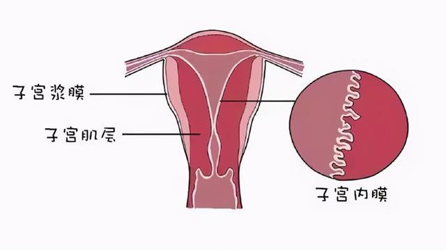 子宫内膜增厚是什么原因导致的?