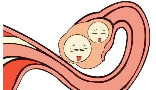 备孕检查出不排卵应该怎么办才好?