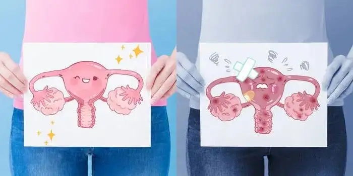 重庆不孕不育专业权威医院|卵巢功能下降是什么原因?