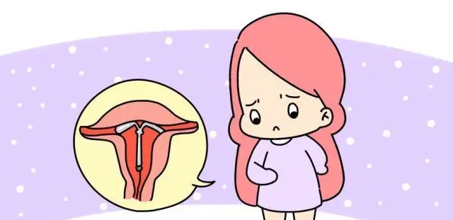 重庆看不孕不育哪家医院专业？出现卵巢早衰的原因有哪些?