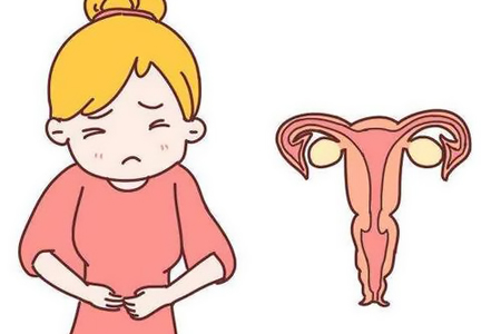 子宫内膜异位引起的不孕有什么症状?