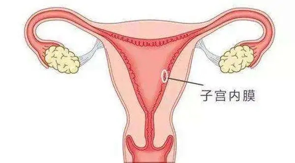 子宫内膜增厚是什么原因造成的?