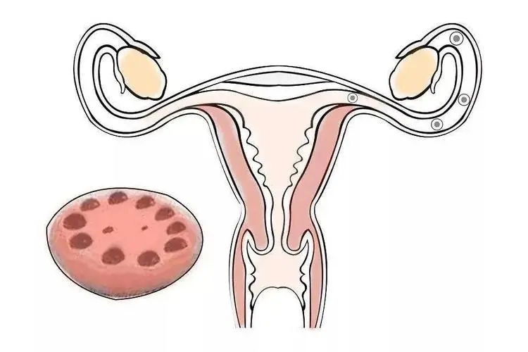 卵泡发育多大才能正常受孕?